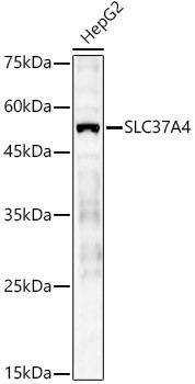 SLC37A4 Antibody in Western Blot (WB)