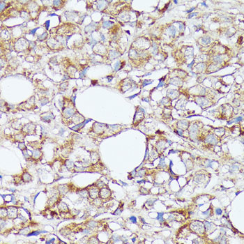 SLC7A2 Antibody in Immunohistochemistry (Paraffin) (IHC (P))