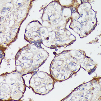 SLC7A2 Antibody in Immunohistochemistry (Paraffin) (IHC (P))