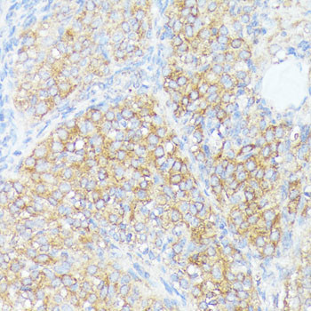 SLC7A2 Antibody in Immunohistochemistry (Paraffin) (IHC (P))