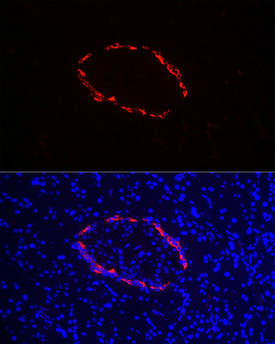 Glucagon Antibody in Immunocytochemistry (ICC/IF)