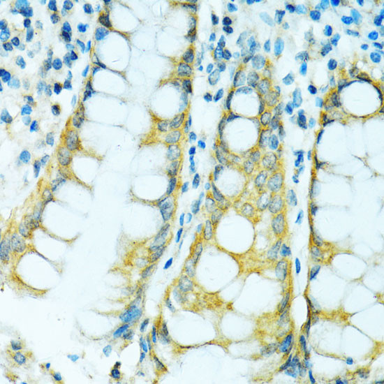 CYP2B6 Antibody in Immunohistochemistry (Paraffin) (IHC (P))