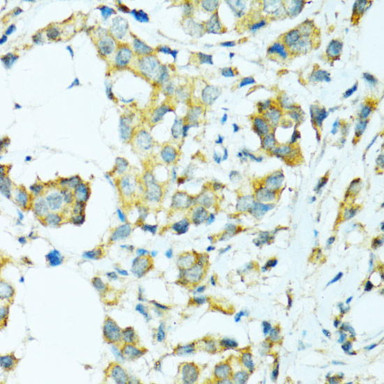 CYP2B6 Antibody in Immunohistochemistry (Paraffin) (IHC (P))