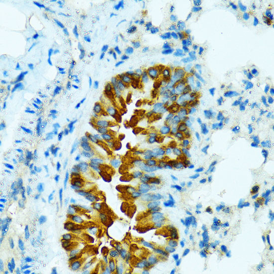 CYP2B6 Antibody in Immunohistochemistry (Paraffin) (IHC (P))