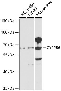 CYP2B6 Antibody in Western Blot (WB)