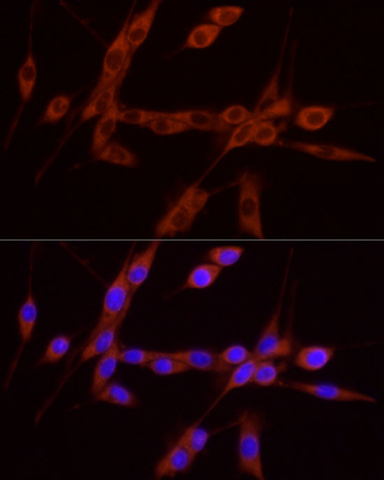 GDNF Antibody in Immunocytochemistry (ICC/IF)