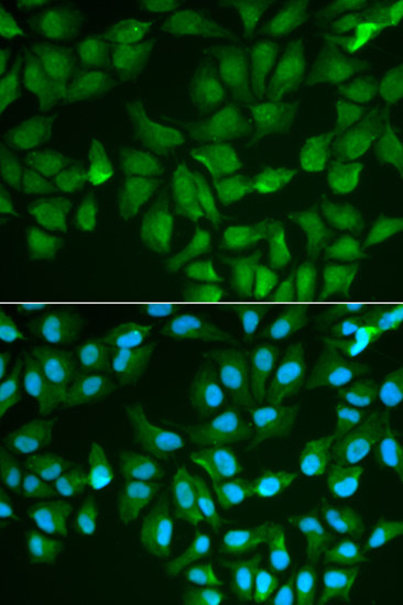 Galectin 3 Antibody in Immunocytochemistry (ICC/IF)