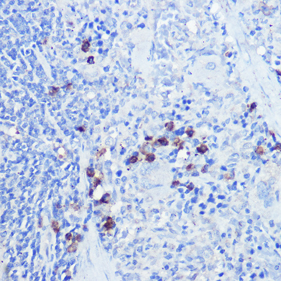 TLR9 Antibody in Immunohistochemistry (Paraffin) (IHC (P))