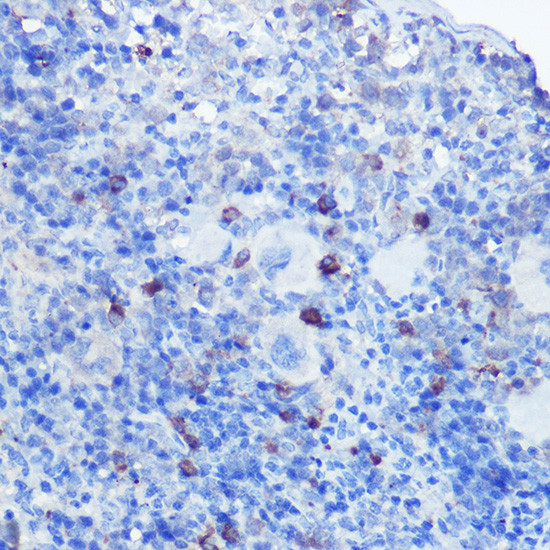 TLR9 Antibody in Immunohistochemistry (Paraffin) (IHC (P))