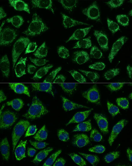 IDH3A Antibody in Immunocytochemistry (ICC/IF)