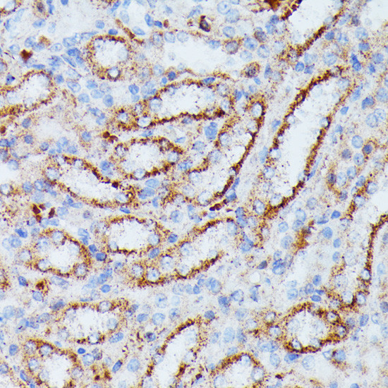 IDH3A Antibody in Immunohistochemistry (Paraffin) (IHC (P))