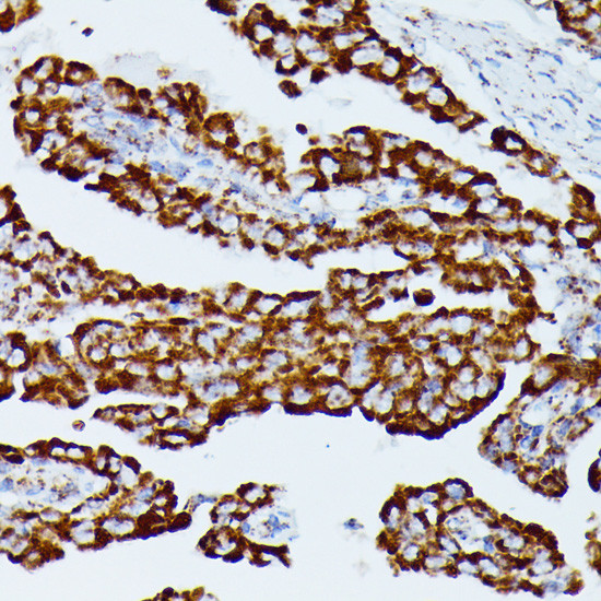 IDH3A Antibody in Immunohistochemistry (Paraffin) (IHC (P))