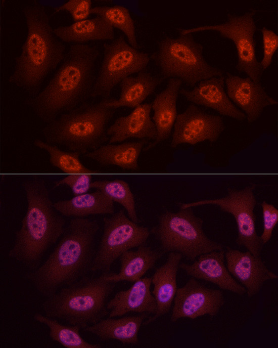 WTAP Antibody in Immunocytochemistry (ICC/IF)