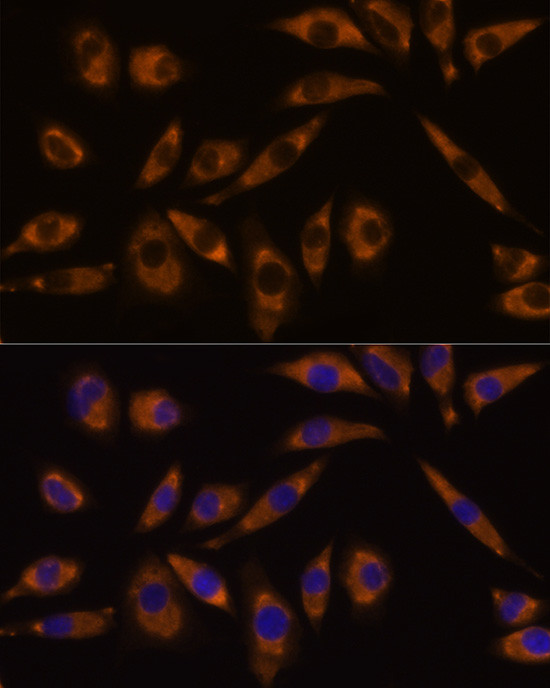 GNAQ Antibody in Immunocytochemistry (ICC/IF)