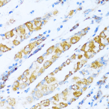 NDUFA5 Antibody in Immunohistochemistry (Paraffin) (IHC (P))