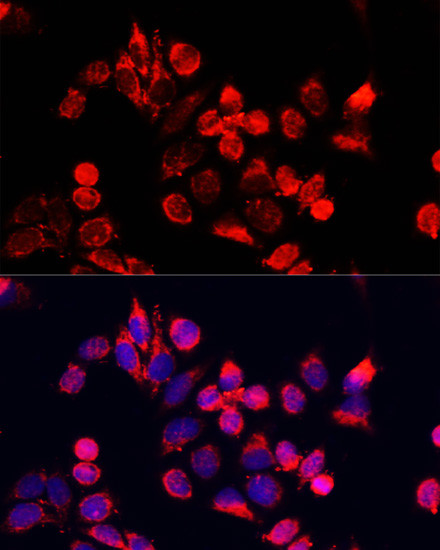 NFE2L1 Antibody in Immunocytochemistry (ICC/IF)