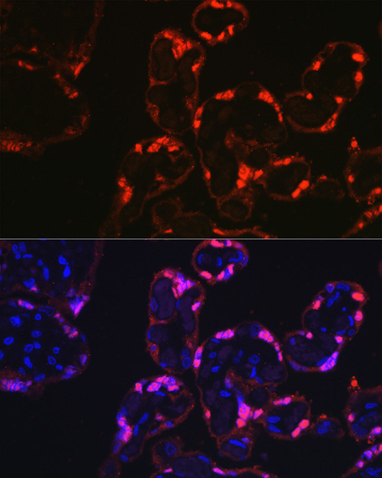 S100P Antibody in Immunocytochemistry (ICC/IF)