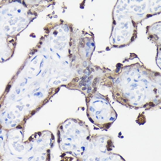 S100P Antibody in Immunohistochemistry (Paraffin) (IHC (P))