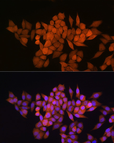 Thioredoxin 1 Antibody in Immunocytochemistry (ICC/IF)