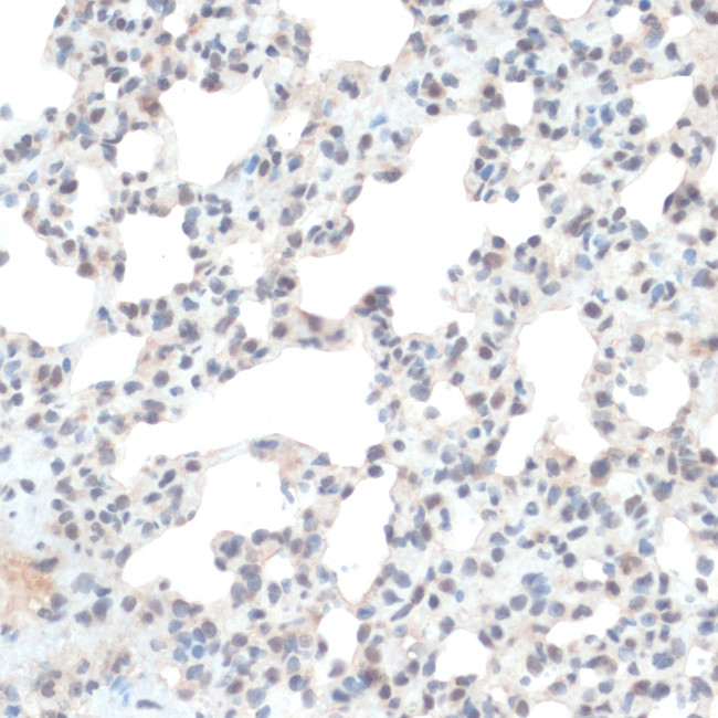 Thioredoxin 1 Antibody in Immunohistochemistry (Paraffin) (IHC (P))