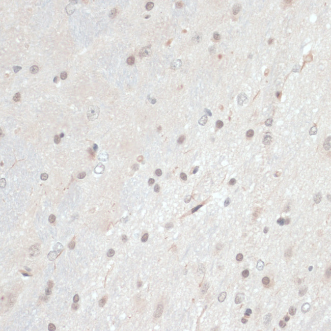 Thioredoxin 1 Antibody in Immunohistochemistry (Paraffin) (IHC (P))