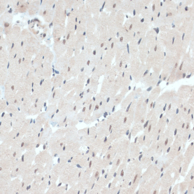 Thioredoxin 1 Antibody in Immunohistochemistry (Paraffin) (IHC (P))