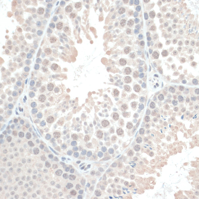 Thioredoxin 1 Antibody in Immunohistochemistry (Paraffin) (IHC (P))