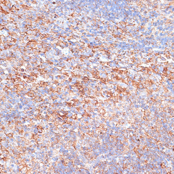 G3BP1 Antibody in Immunohistochemistry (Paraffin) (IHC (P))