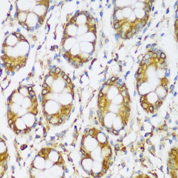 ERLIN1 Antibody in Immunohistochemistry (Paraffin) (IHC (P))