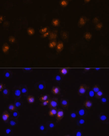 SWAP70 Antibody in Immunocytochemistry (ICC/IF)