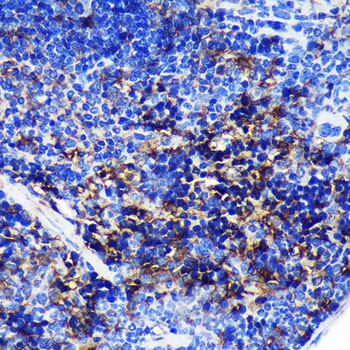 SWAP70 Antibody in Immunohistochemistry (Paraffin) (IHC (P))