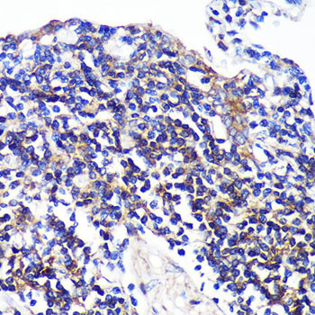 SWAP70 Antibody in Immunohistochemistry (Paraffin) (IHC (P))