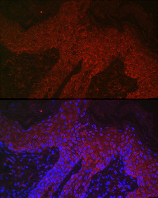 DKK2 Antibody in Immunohistochemistry (Paraffin) (IHC (P))