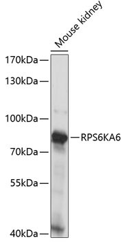 RSK4 Antibody in Western Blot (WB)