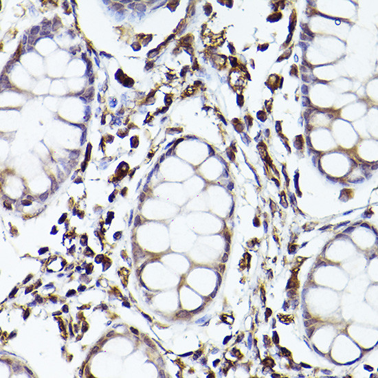 TLR8 Antibody in Immunohistochemistry (Paraffin) (IHC (P))