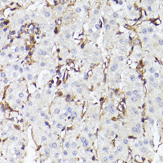 TLR8 Antibody in Immunohistochemistry (Paraffin) (IHC (P))