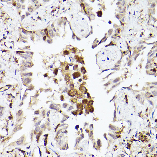 TLR8 Antibody in Immunohistochemistry (Paraffin) (IHC (P))