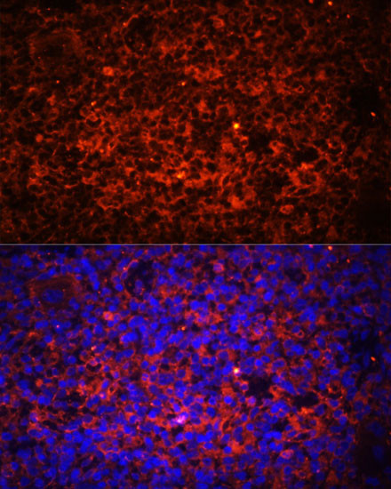 TLR8 Antibody in Immunohistochemistry (Paraffin) (IHC (P))