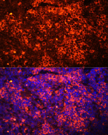 TLR8 Antibody in Immunohistochemistry (Paraffin) (IHC (P))