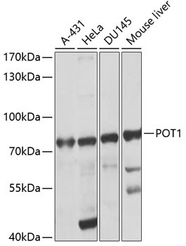POT1 Antibody in Western Blot (WB)