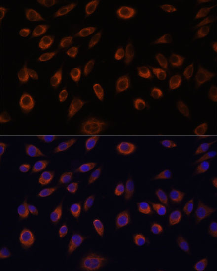 C1orf57 Antibody in Immunocytochemistry (ICC/IF)