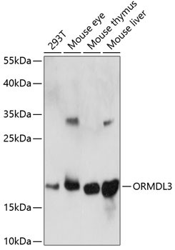 ORMDL3 Antibody in Western Blot (WB)