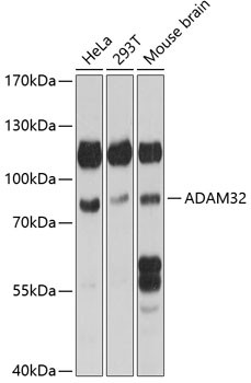 ADAM32 Antibody in Western Blot (WB)