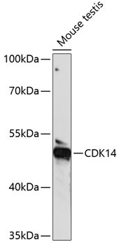 PFTK1 Antibody in Western Blot (WB)