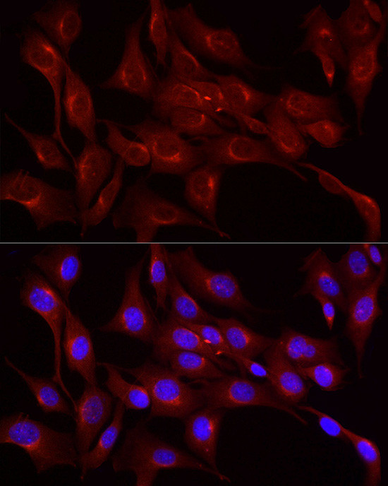 LDLR Antibody in Immunocytochemistry (ICC/IF)