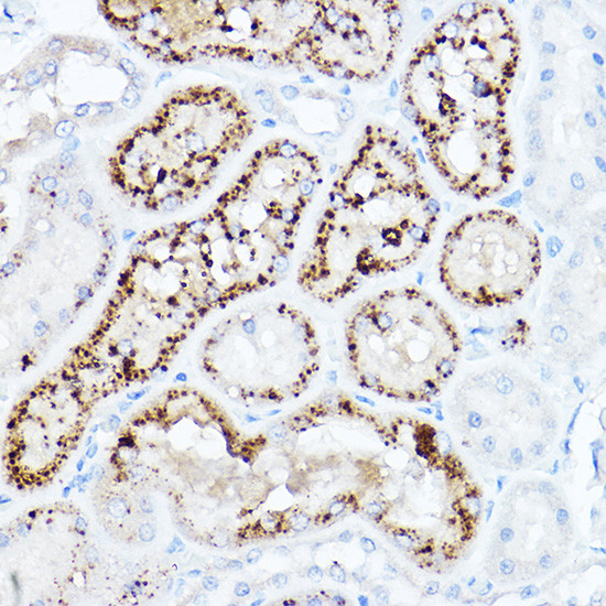 LDLR Antibody in Immunohistochemistry (Paraffin) (IHC (P))