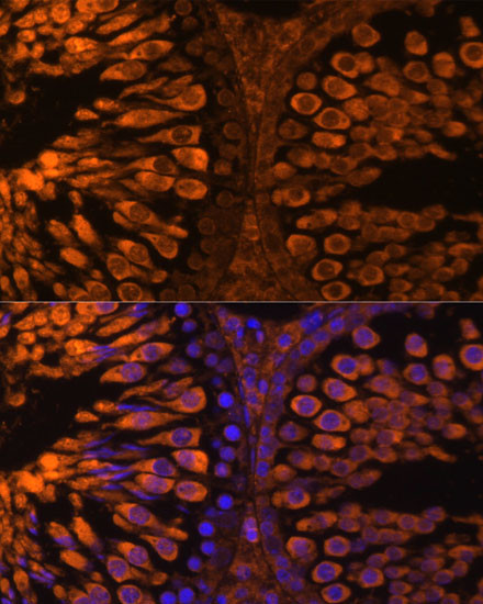 LDHC Antibody in Immunohistochemistry (Paraffin) (IHC (P))