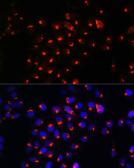 SGMS1 Antibody in Immunocytochemistry (ICC/IF)