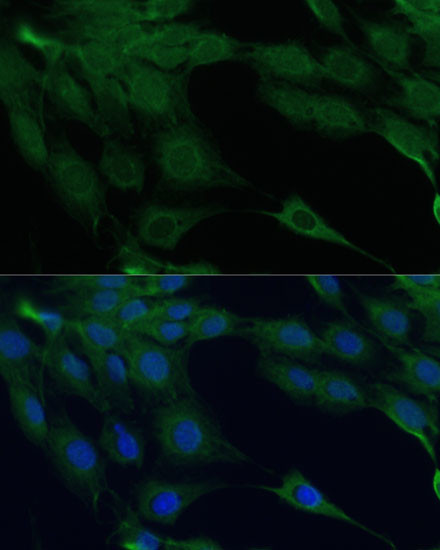 ZIPK Antibody in Immunocytochemistry (ICC/IF)