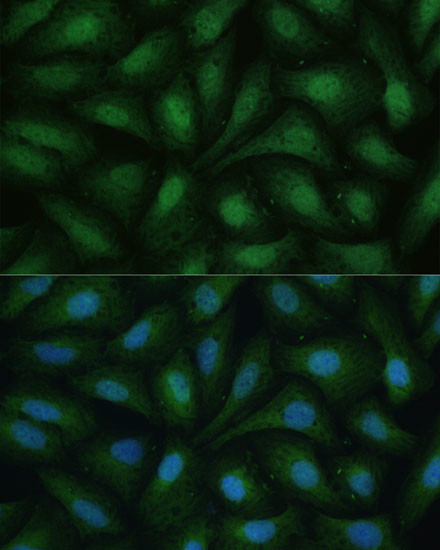 ZIPK Antibody in Immunocytochemistry (ICC/IF)